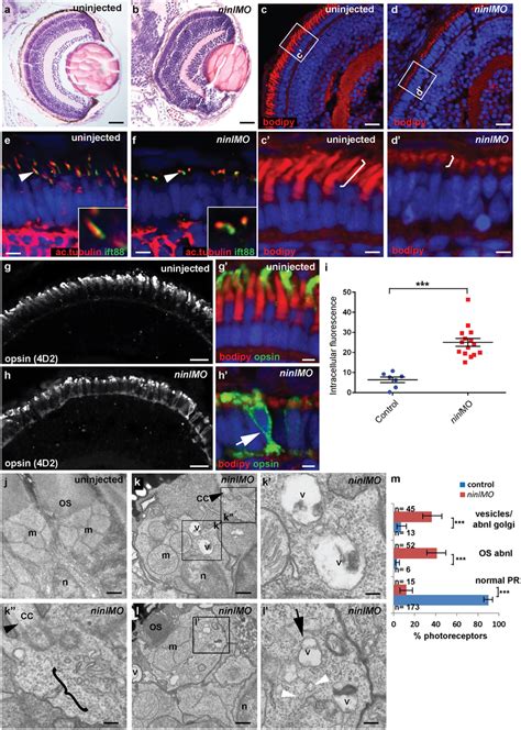 Zebrafish Ninl Knockdown Causes Loss Of Axonemes And Outer Segments