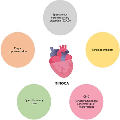 Coronary microvascular dysfunction and myocardial infarction with non ... 