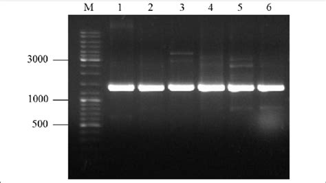 Agarose Gel Electrophoresis Analysis Of 16s Rrna Genes Amplified From