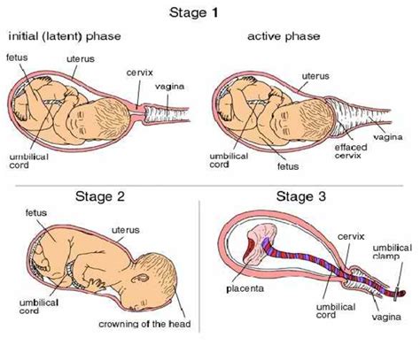 Stages of Labor - HubPages