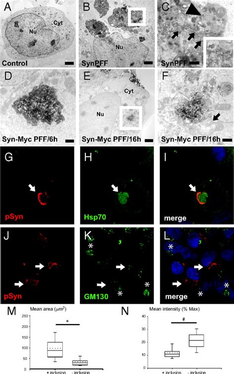 Exogenous α Synuclein Fibrils Seed The Formation Of Lewy Body Like