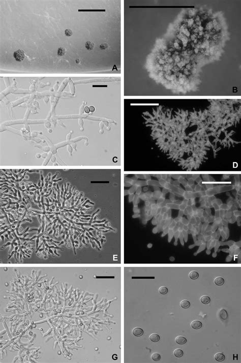 Trichoderma Theobromicola A And B Pustules Formed On CMD Note The