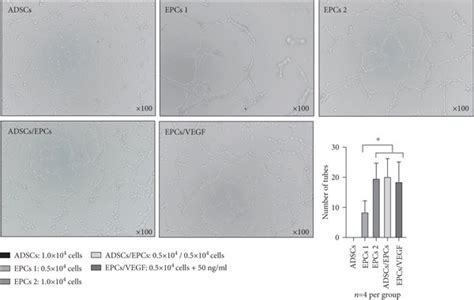 Adscs Enhanced The Proliferation And Angiogenesis Of Epcs In Vitro A Download Scientific