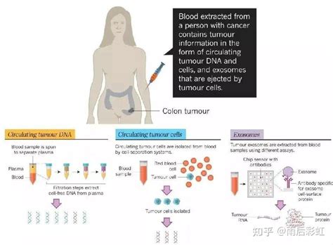 癌症筛查小知识 摘取 知乎