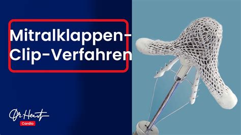 Herzklappe Reparieren Ohne Operation Der MitraClip Eingriff Dr