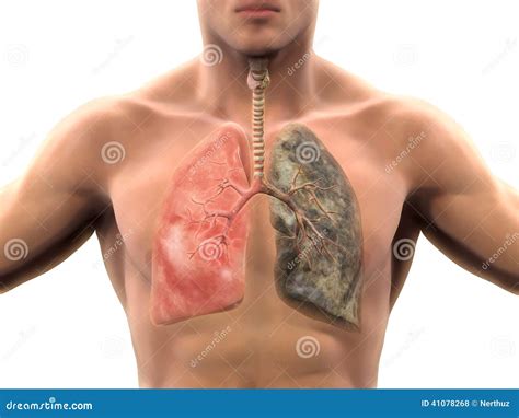 Healthy Lung And Smokers Lung Stock Illustration Illustration Of