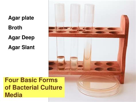 Ppt Ex 8 Aseptic Technique Inoculating Different Types Of Media