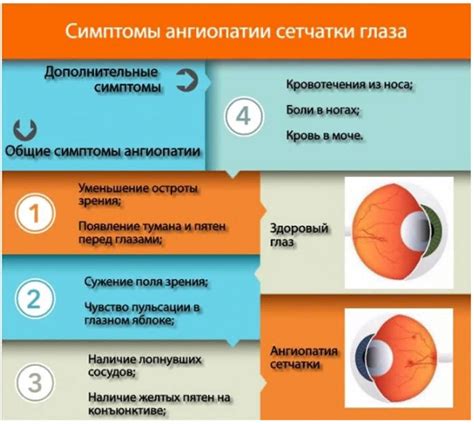 Сетчатка глаза: строение, структура, функции, слои, симптомы ...