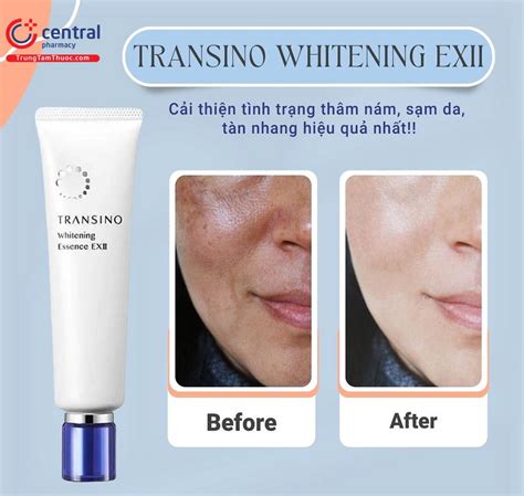 CHÍNH HÃNG Tinh chất trị nám Transino Whitening Essence ExII 50g