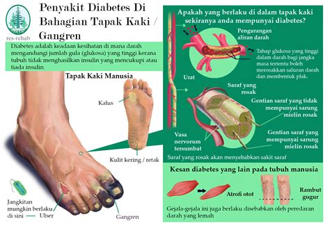 Punca Berlakunya Penyakit Diabetes Luke Poole