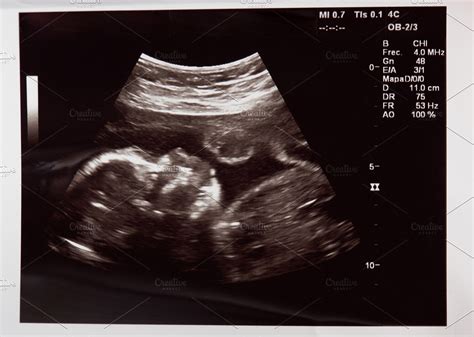 Baby head on ultrasound scan | High-Quality Health Stock Photos ...