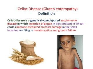 Celiac disease in children 2021 | PPT