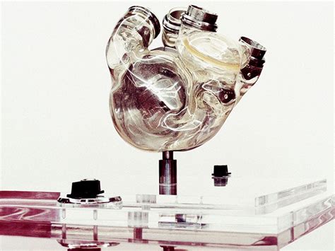 Mechanical Circulatory Support Devices The Artificial Heart And VADs