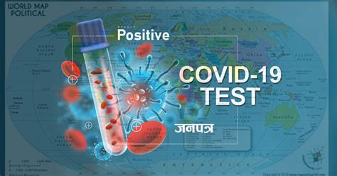 विश्व कोरोना अपडेटः मृत्यु हुनेको संख्या ४ लाख १८ हजार बढि