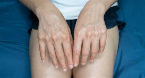 These Symptoms Indicate That You Have Poor Blood Circulation Archyde