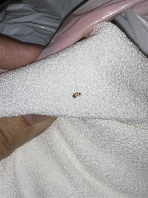 What Does A Bed Bug Exoskeleton Look Like at Eric Hutchinson blog