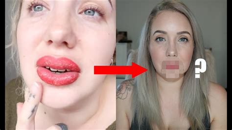 Top 72 Lip Tattoo Before And After Best In Cdgdbentre