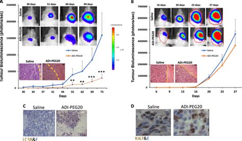 Efficacy Of Arginine Depletion By Adi Peg In An Intracranial Model Of