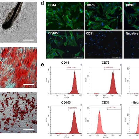 Isolation And Characterization Of Human Hair Follicle Mesenchymal Stem