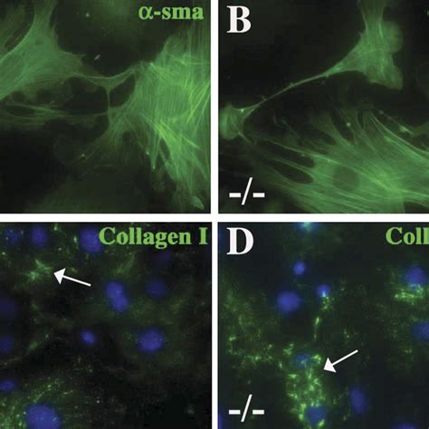 Cultures Of Sparc Null Cardiac Fibroblasts Exhibit Increased