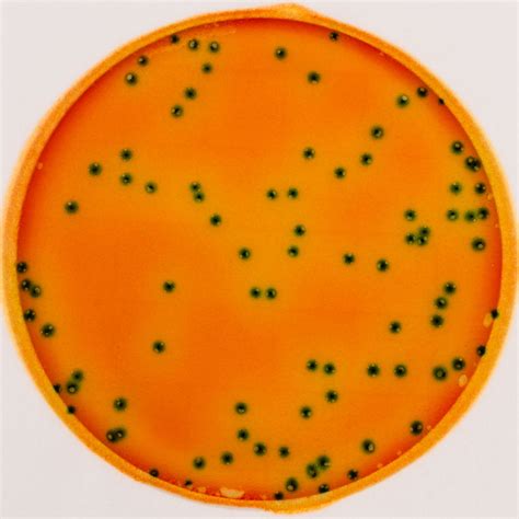 Reference Material For Petrifilm Rapid E Coli And Coliform Count Plates