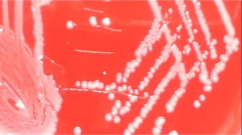 Moraxella Catarrhalis Introduction Morphology Pathogenicity Lab