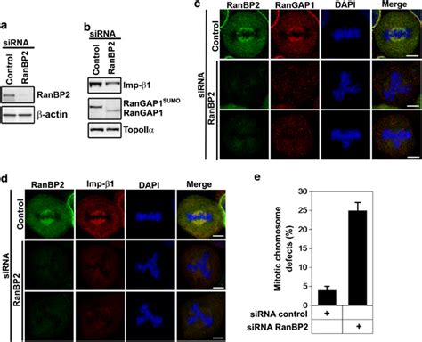 Ranbp2 Sirna Treatment Reduces Importin β1 And Causes Abnormal