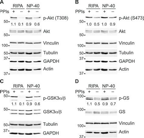 Phosphatase Inhibitors Are Critical To Preserve Certain Phosphorylated