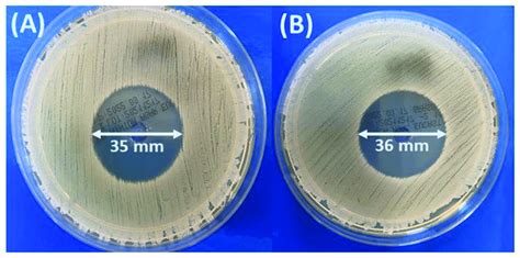 Inhibition Zones Of Staphylococcus Aureus Atcc 25923 After Culture Download Scientific