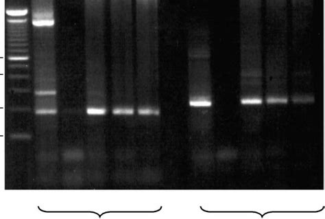 Agarose Gel Electrophoresis Of Products Of Pcr Amplification Of Cdna