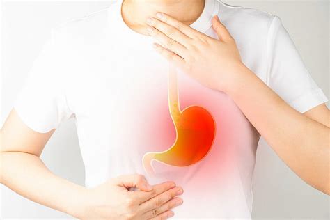 Heartburn Acid Reflux Causes Complications And Treatment Options