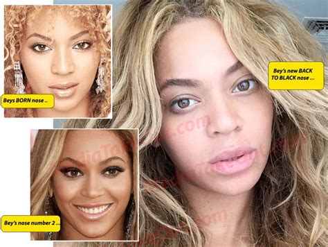 Mto Exclusive Beyonce Unveils Her New Nosejob She Had Her New