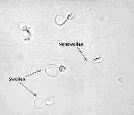 The Spermatozoa Incubated In Hypo Osmotic Solution The Host