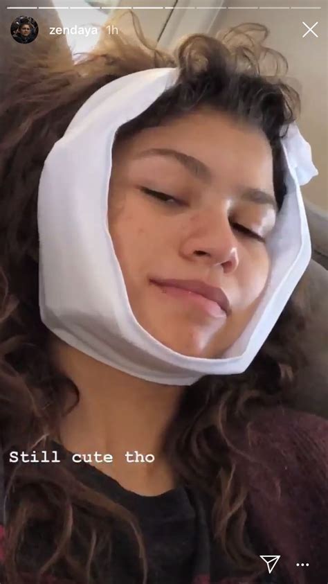 Zendaya Updates Fans With Funny Videos After Getting Her Wisdom Teeth ...