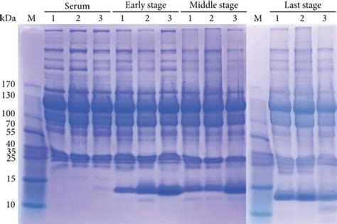 Sds Page Separation Of Serum And Exudate Protein At Different Treatment