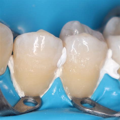 Сообщество «All Dental/Вся Стоматология» ВКонтакте — стоматология, Москва