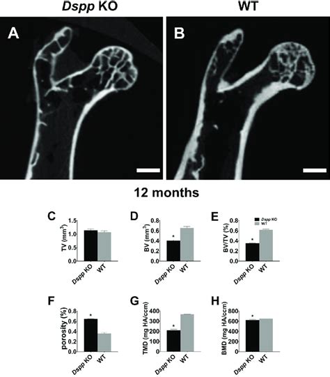 Micro Ct Analyses For Coronal Sections Of Femoral Heads At 12 Months