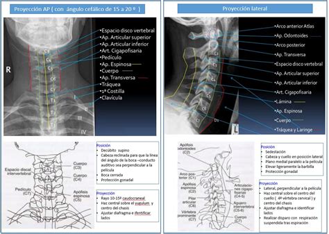 Radiografía Lateral De Anatomía Del Cuello