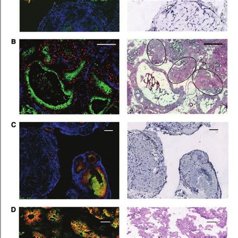 A, representative fluorescence overlay image [pimonidazole (green ...