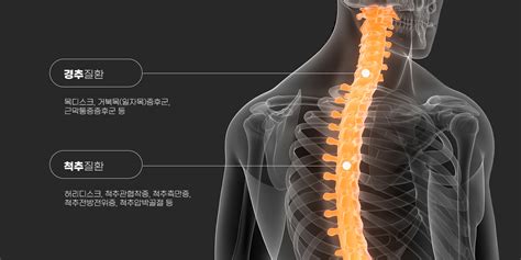 야탑 삼성마디탑정형외과