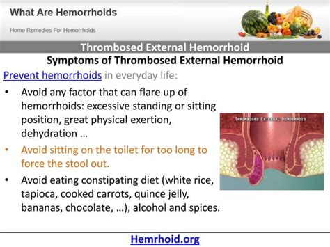 Thrombosed External Hemorrhoid