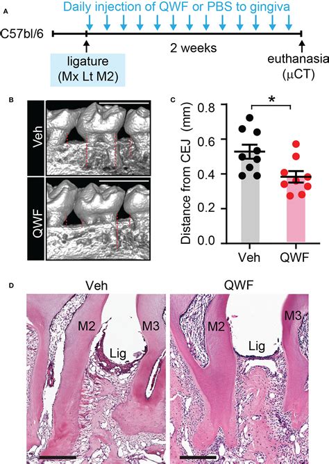 Frontiers Substance P Aggravates Ligature Induced Periodontitis In Mice