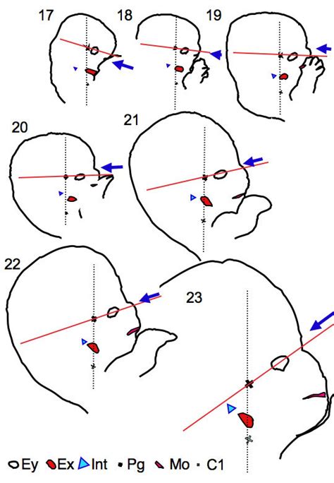 Hearing Outer Ear Development Embryology