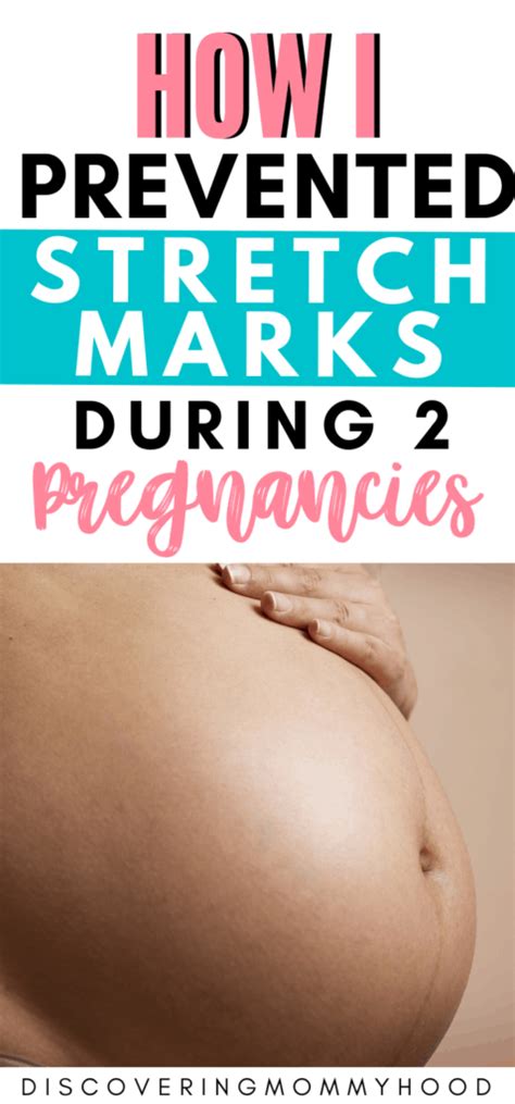 How To Prevent Pregnancy Stretch Marks Discovering Mommyhood