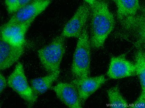 MIF antibody (30957-1-AP) | Proteintech