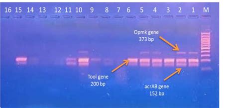 Agarose Gel Electrophoresis Image That Showed The Multiplex Pcr Product