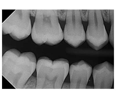 Dental Checkups in Gosford, Central Coast - 7 Days: VC Dental