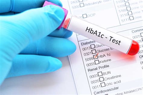 HbA1c Test For Diabetes Diagnosis Target HbA1c Home Tests