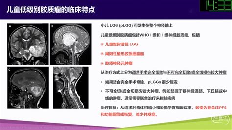 赵阳博士：儿童低级别胶质瘤的靶向治疗 脑医汇 神外资讯 神介资讯