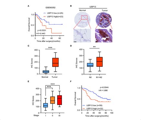 USP13 Is Overexpressed In SCLC And Predicts Poor Clinical Outcomes